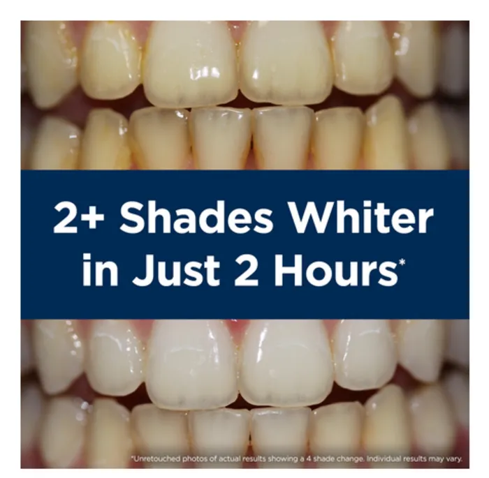 29521 teeth whitening at home