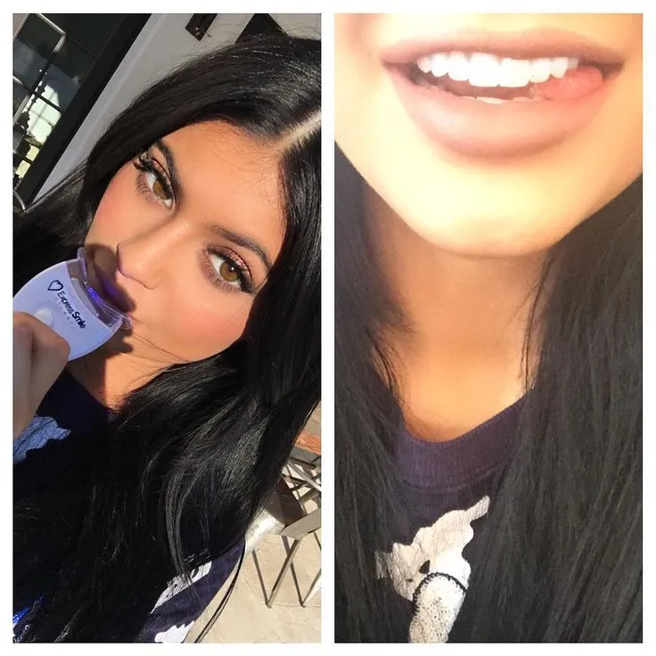 29528 teeth whitening products