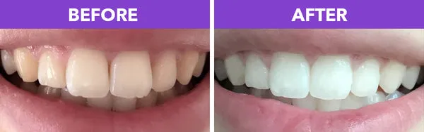 29530 led light ismile