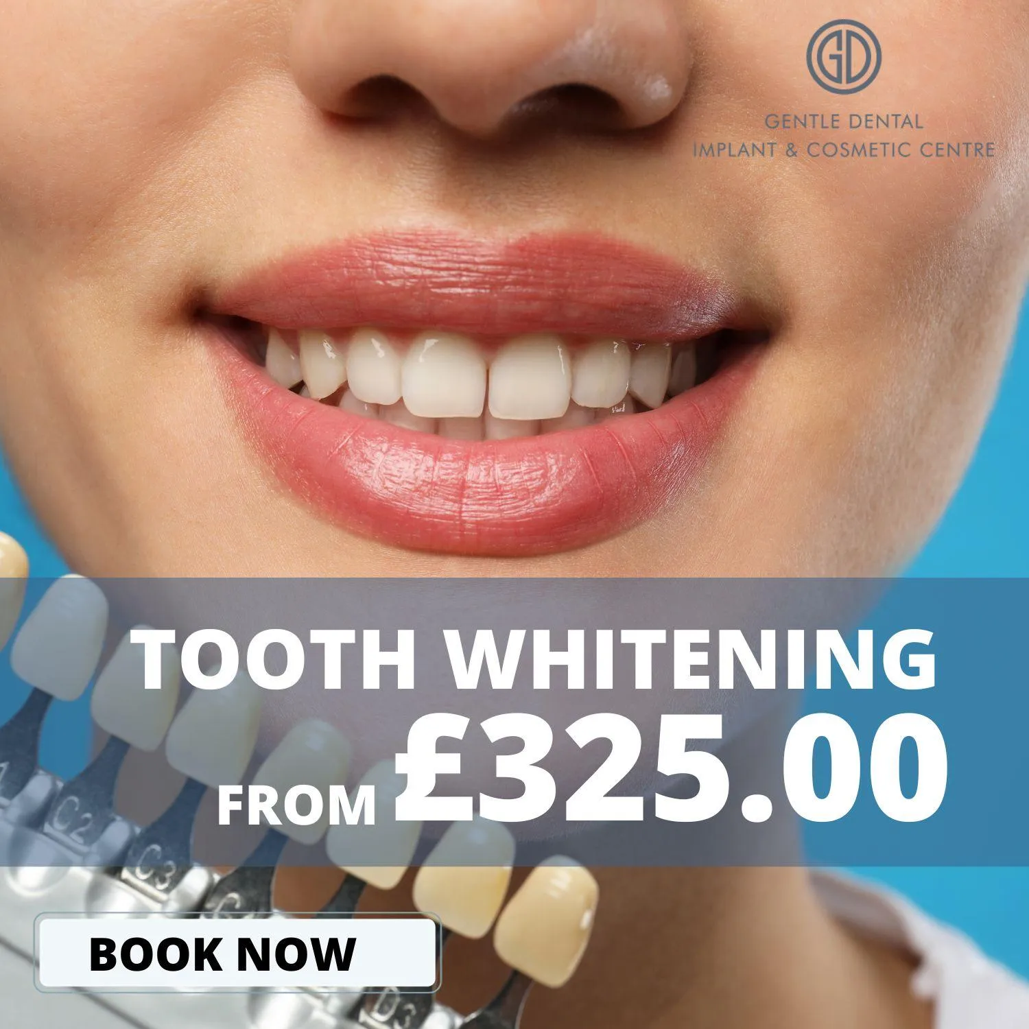 29532 at home teeth whitening kit