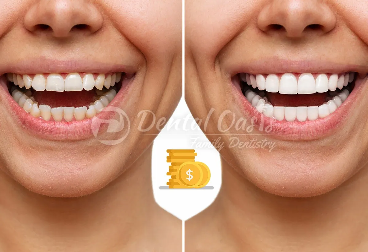 /img/29532-happy-patient-teeth-whitening.webp