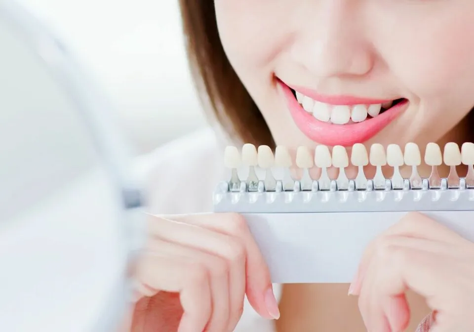 29532 teeth whitening procedure