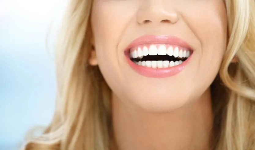 29532 teeth whitening results