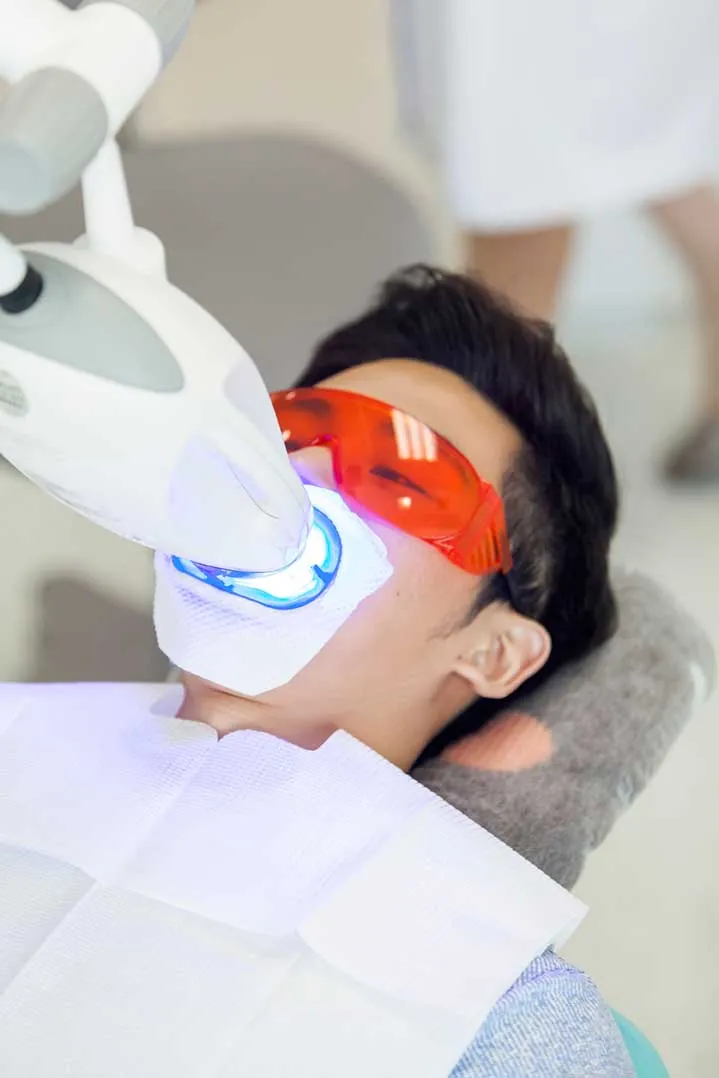 29537 applying teeth whitening gel