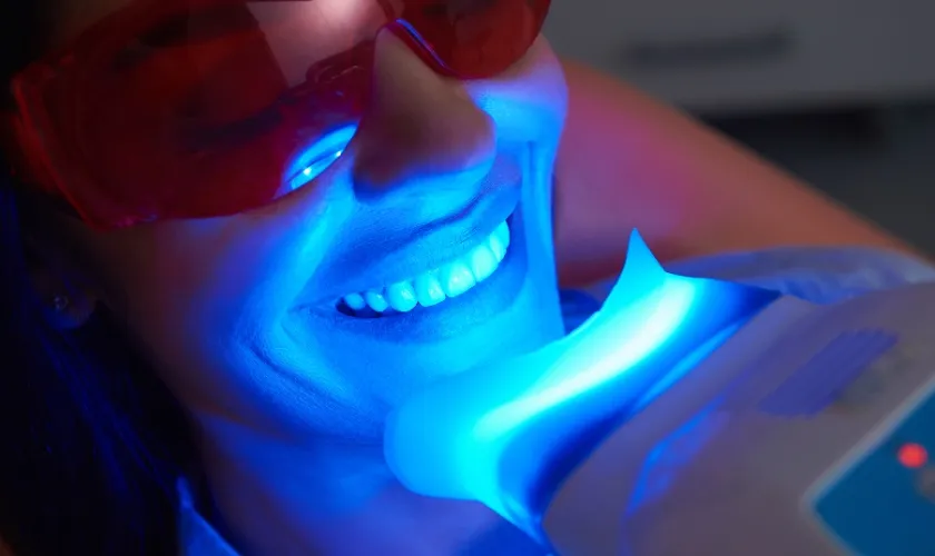 /img/29538-laser-teeth-whitening-gum-irritation.webp