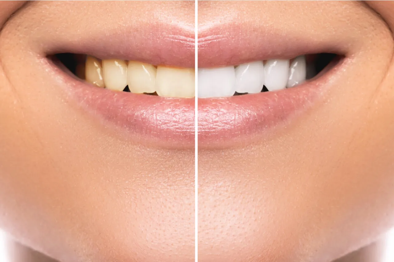 /img/29540-avoiding-whitening-triggers.webp