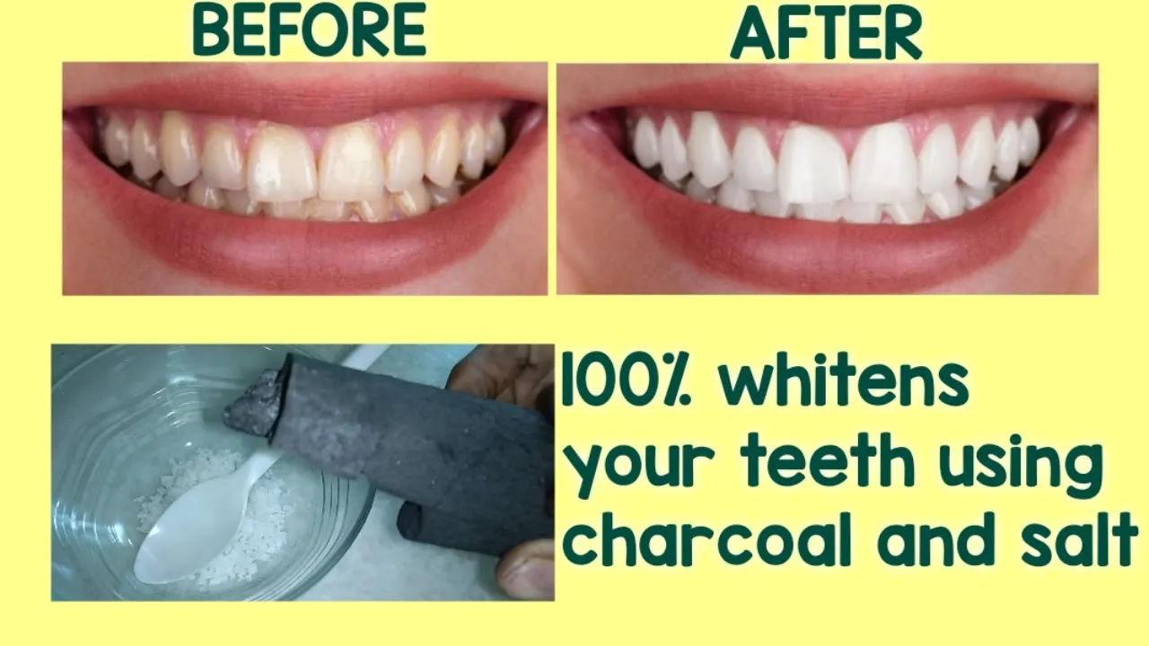 29542 white teeth smile