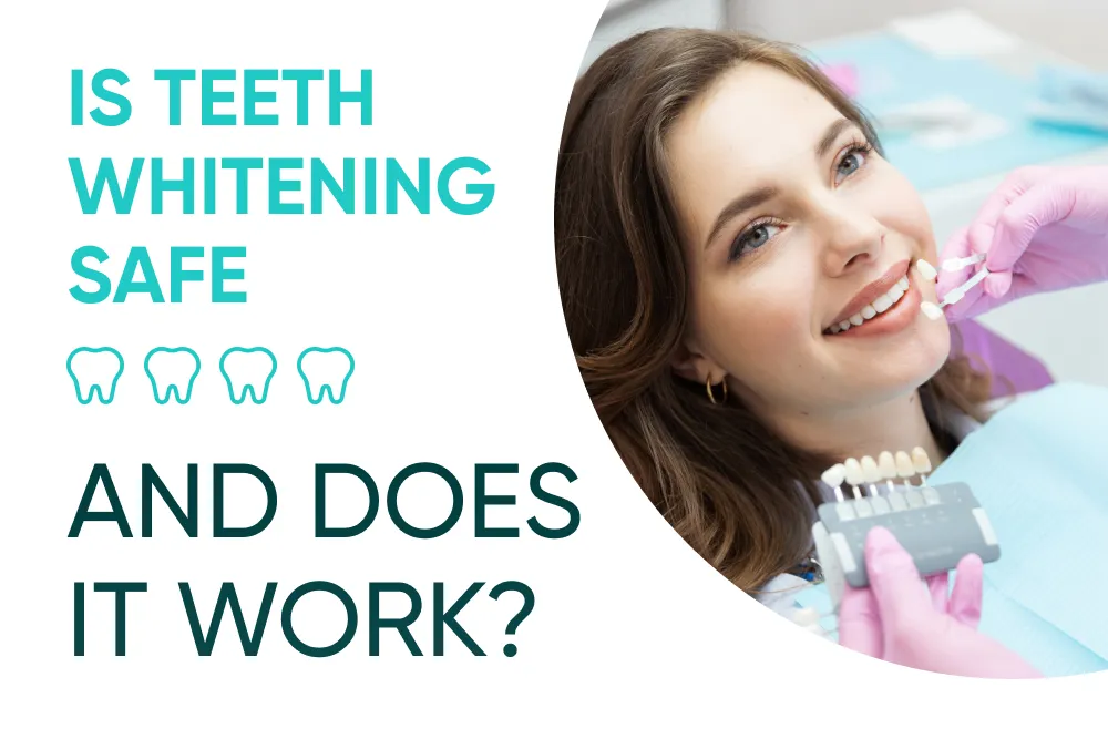 29549 at home teeth whitening