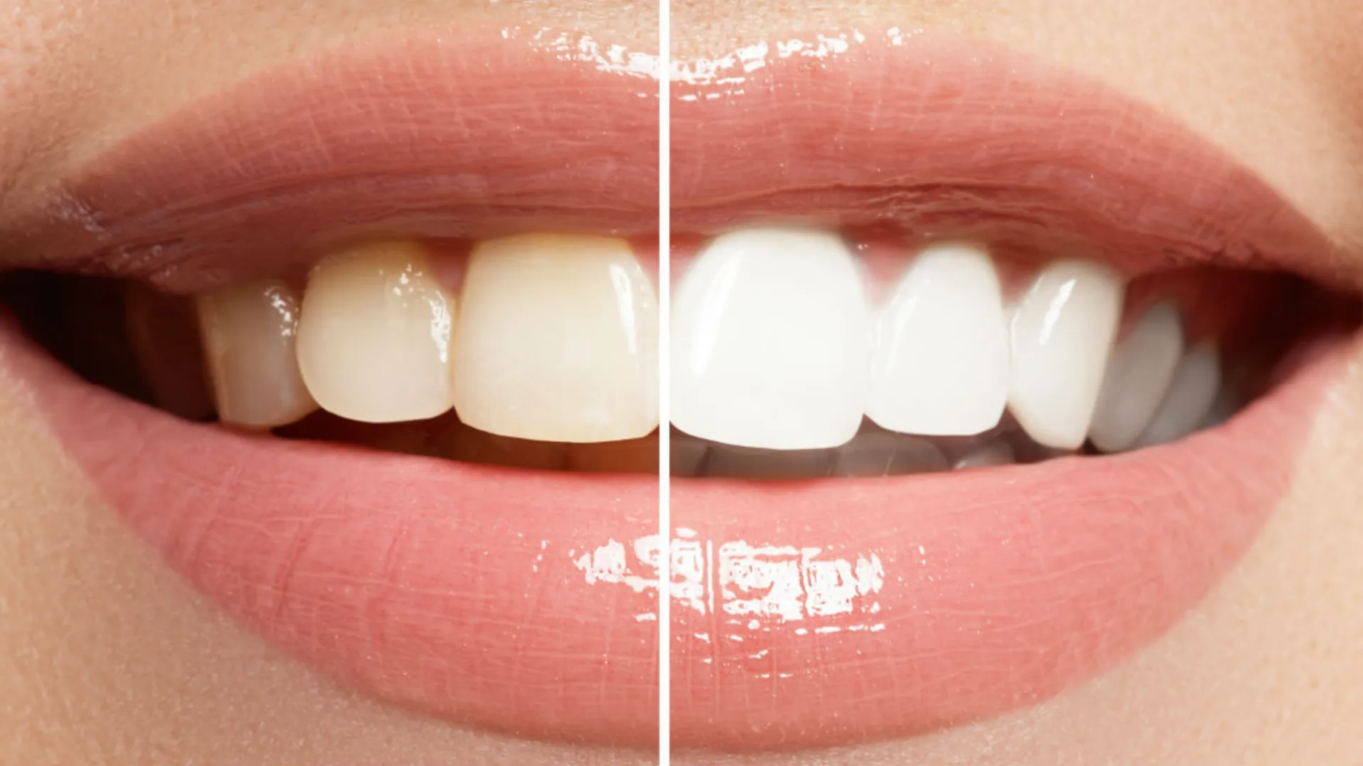 29549 healthy gums