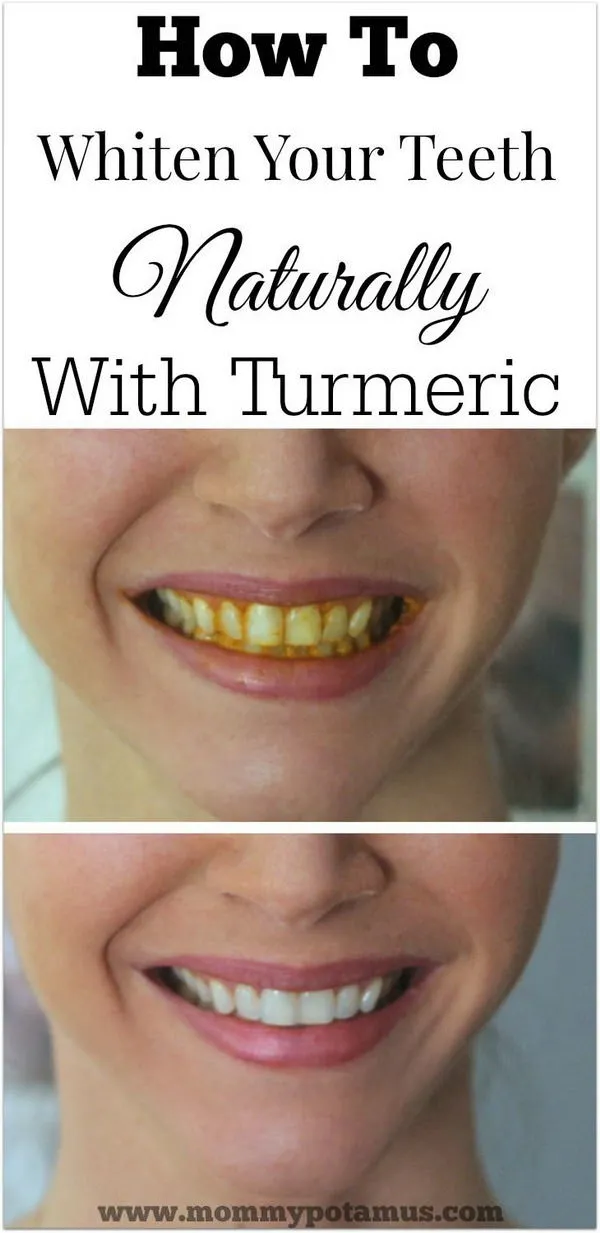 29553 avoid staining foods