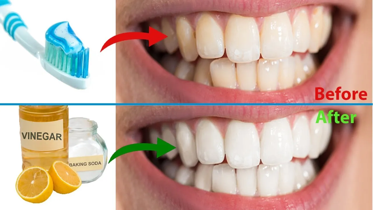 29553 baking soda teeth