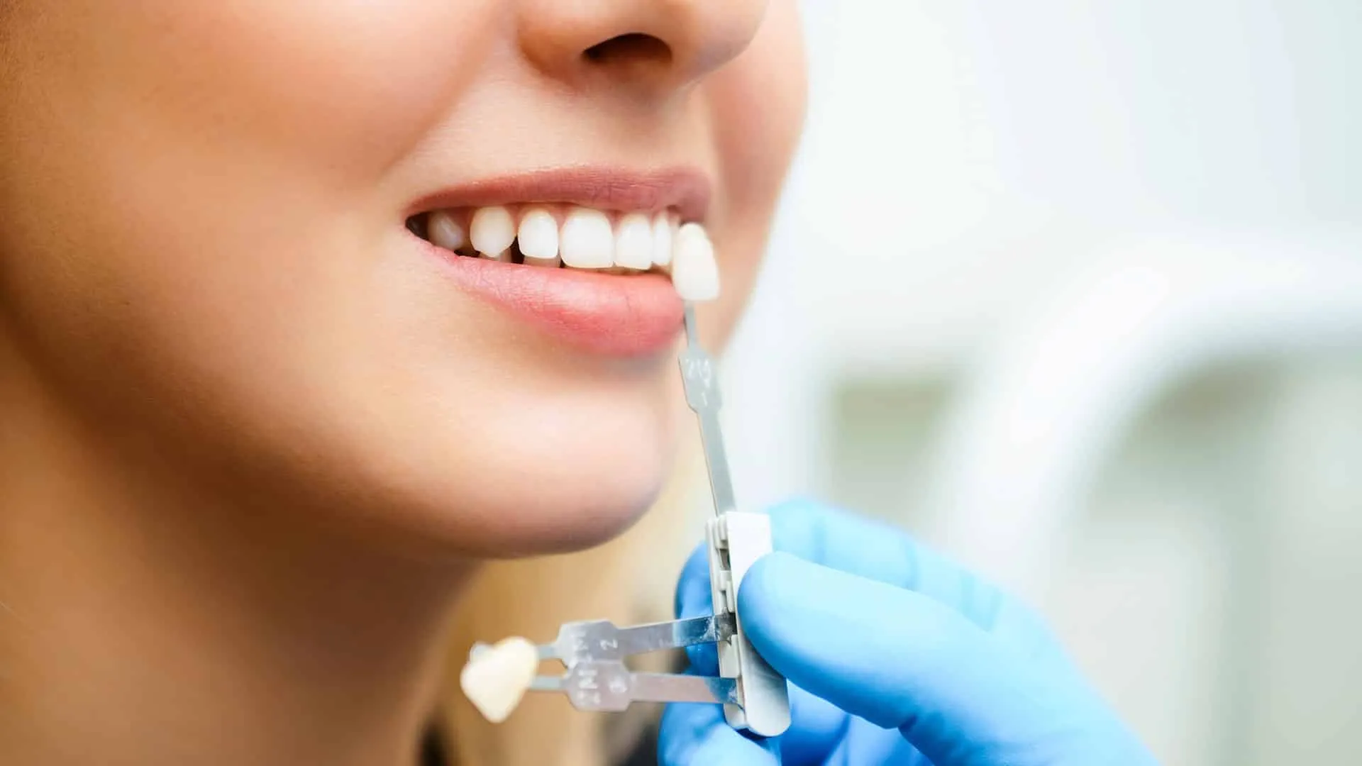 29554 spokane teeth whitening procedure