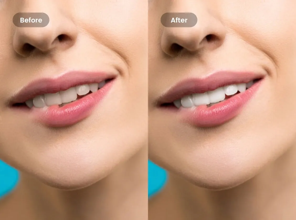 29555 teeth whitening app choosing