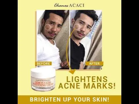 29562 skin care routine