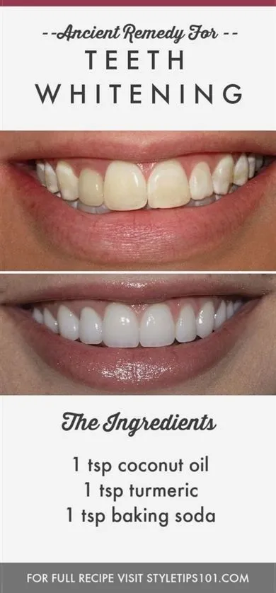 29564 sensitive teeth