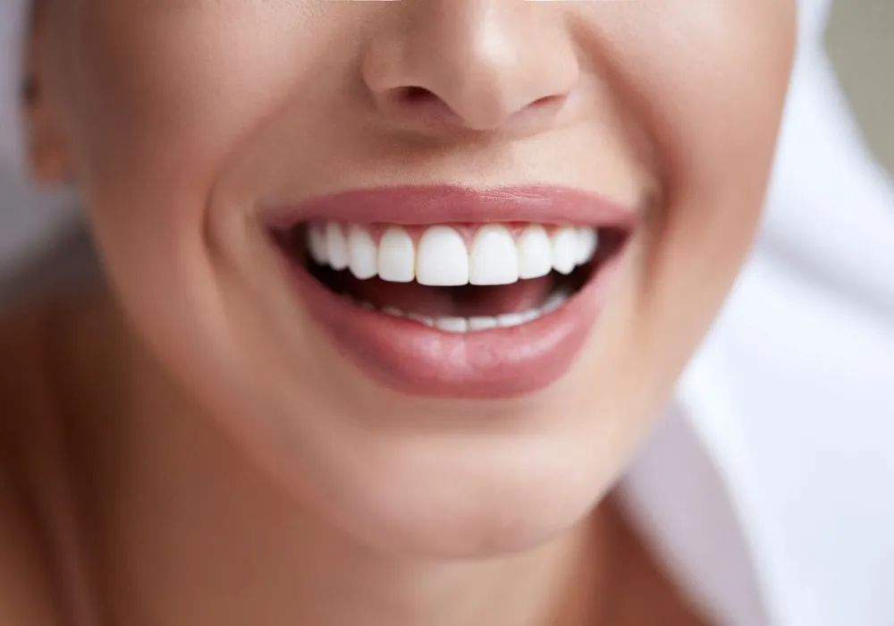 29564 teeth whitening process