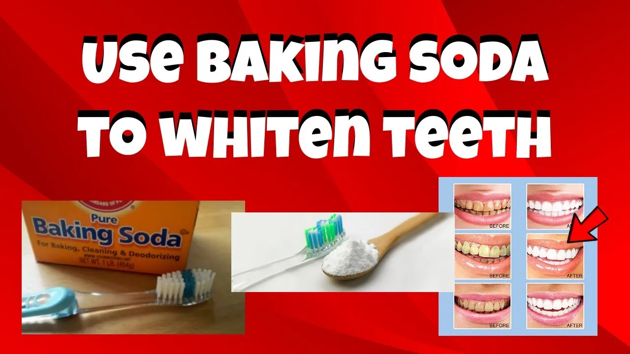 29566 over the counter whitening