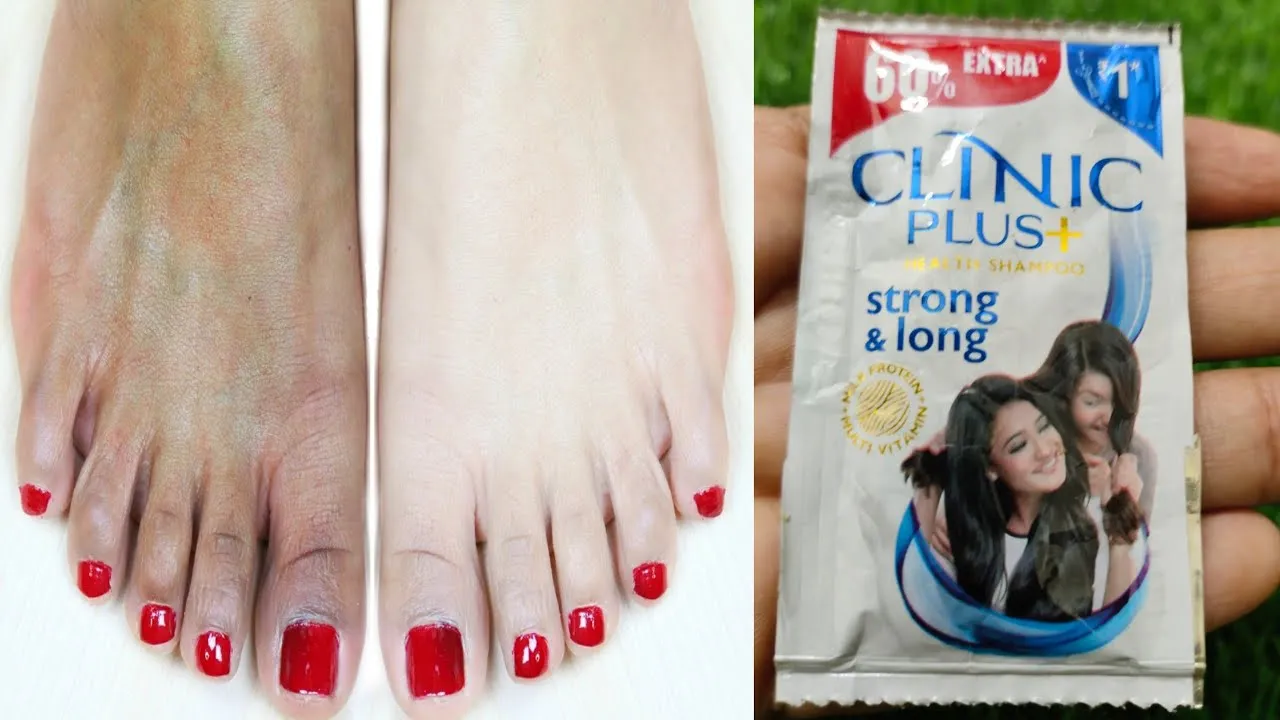 29567 sun exposure feet