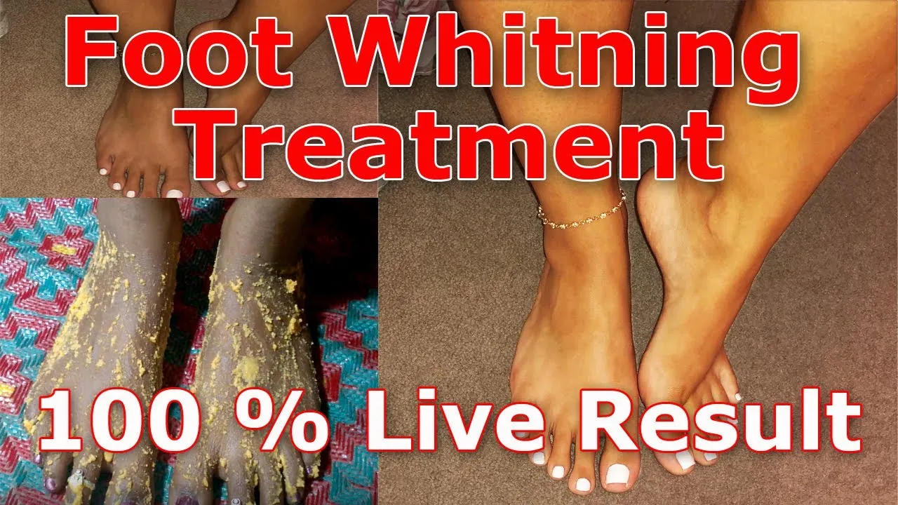 29567 whitening creams feet
