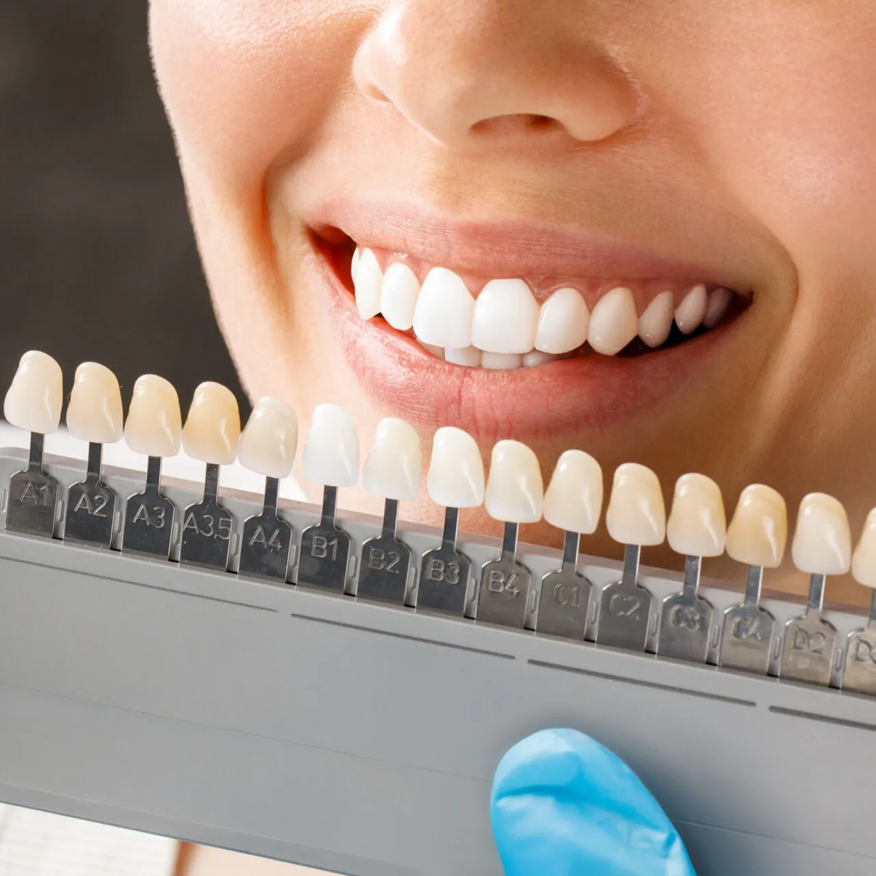 29574 teeth whitening liverpool clinic