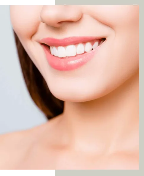 29580 teeth whitening surprise az 1