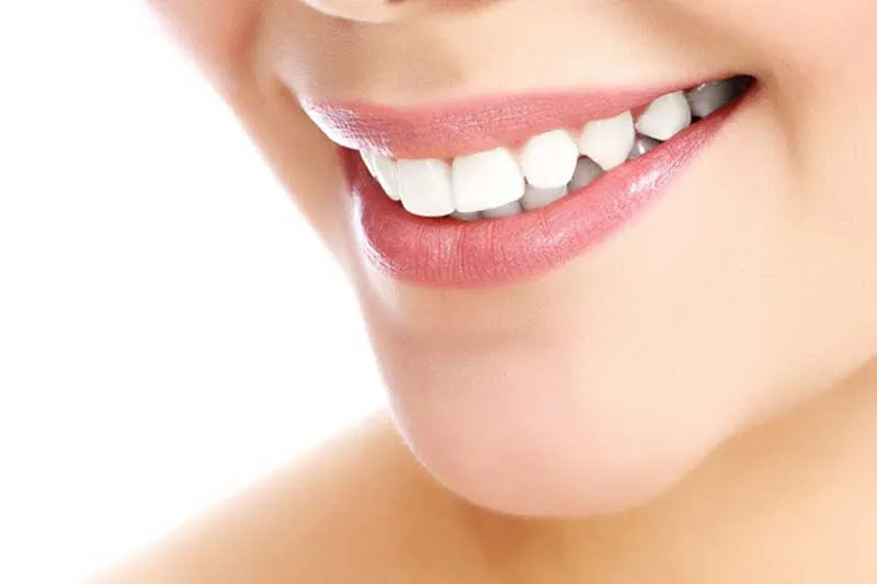 29580 teeth whitening surprise az 2