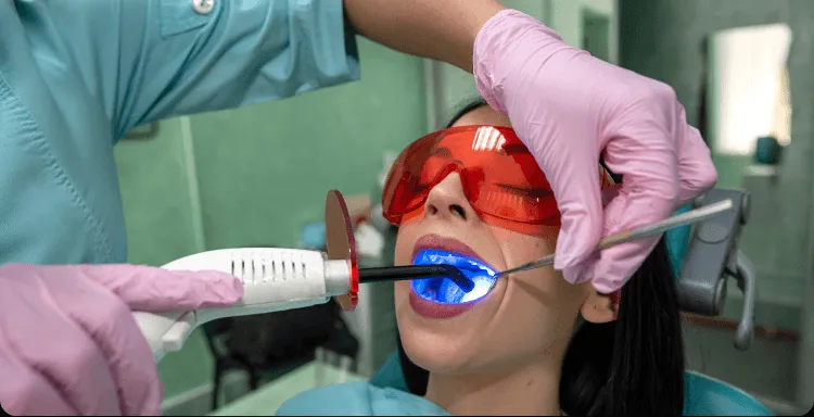 29583 teeth whitening sf image4