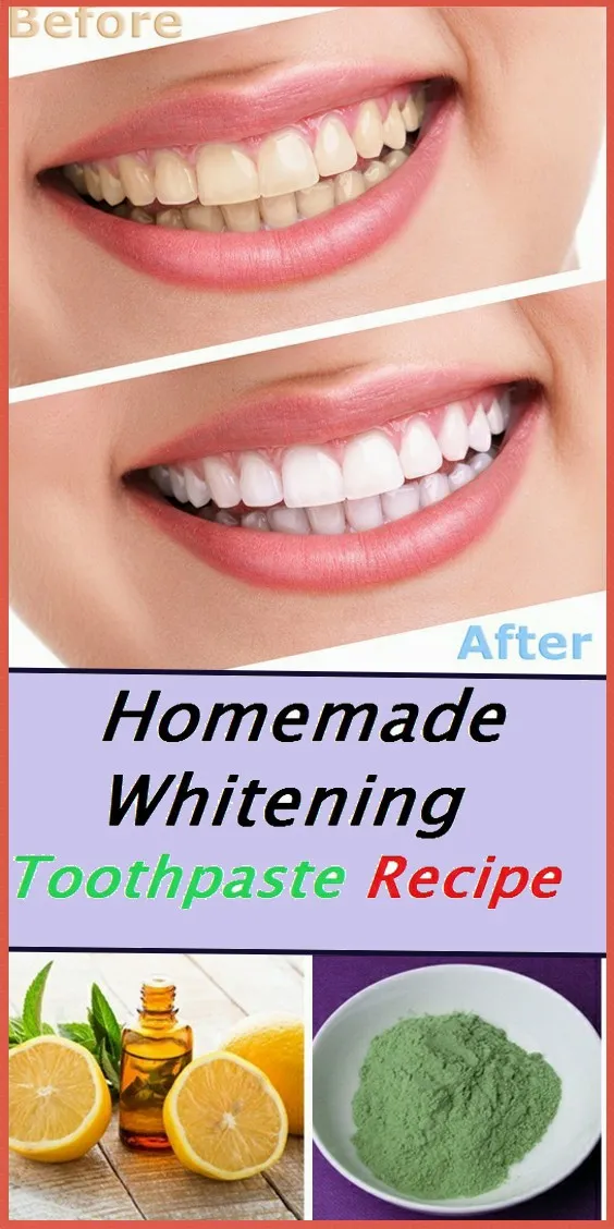 29590 teeth whitening comparison