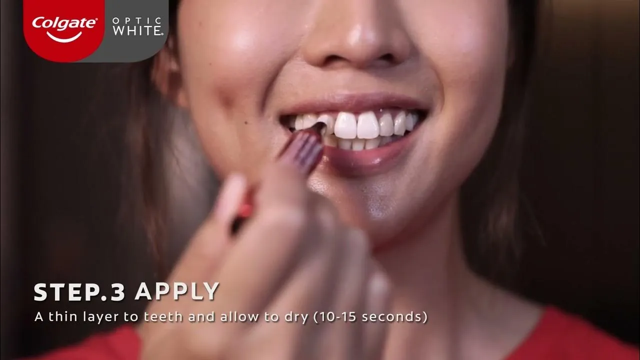 29592 teeth whitening