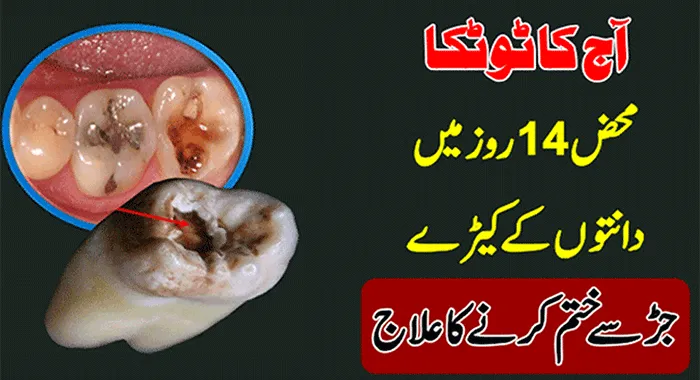 29596 fluoride toothpaste