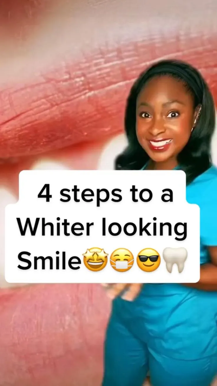 29596 teeth whitening kit