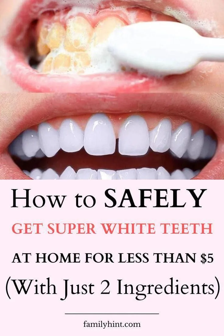 29596 tooth decay bacteria