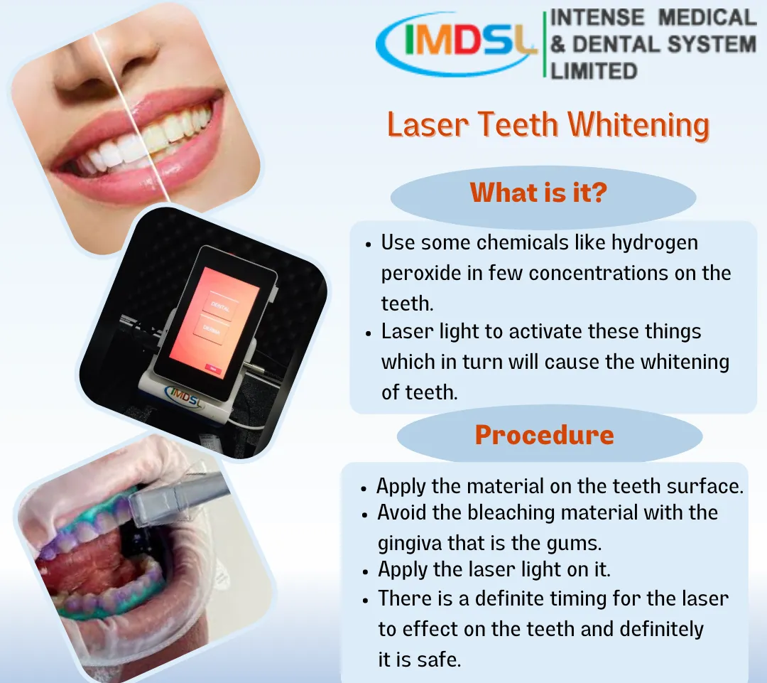 29605 teeth whitening laser product 5