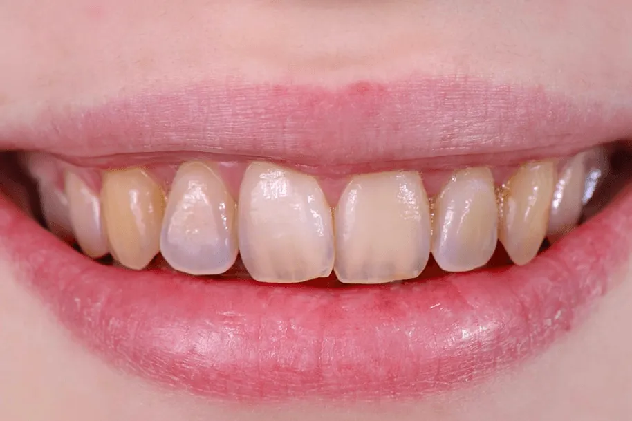 29608 dental hygiene