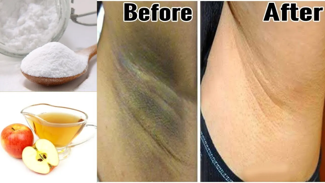 29609 dark underarms