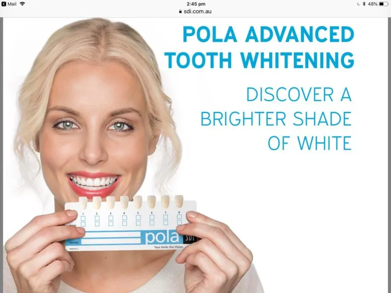 29610 teeth whitening before and after