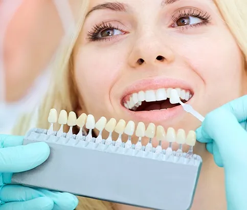 29613 take home whitening kits