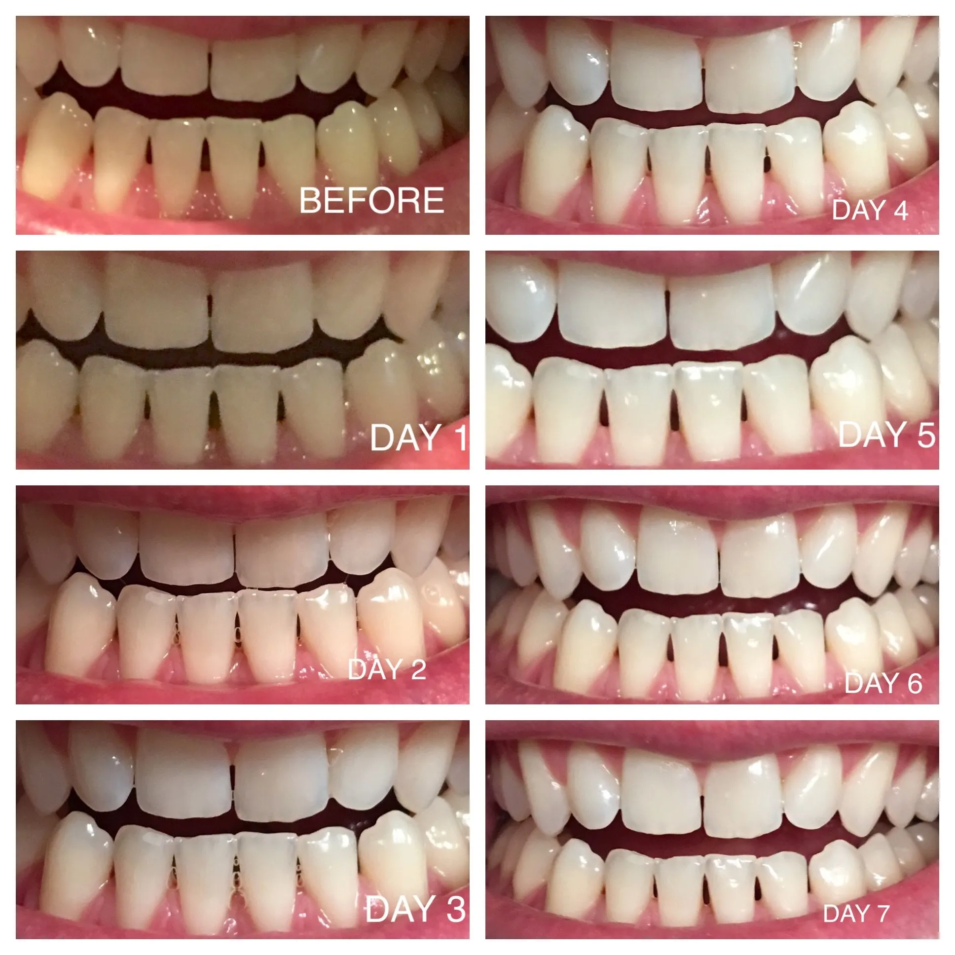 29622 whitening strips alternatives