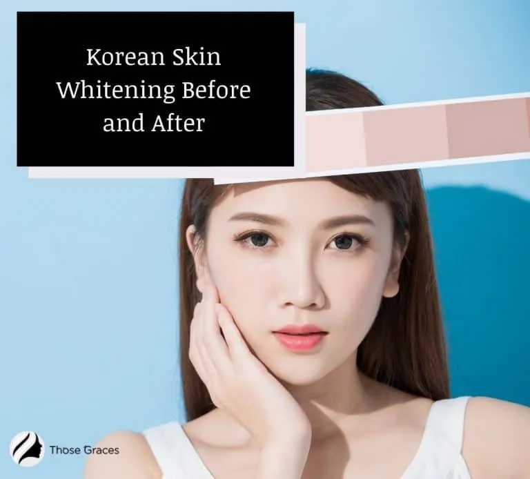 29625 laser skin whitening