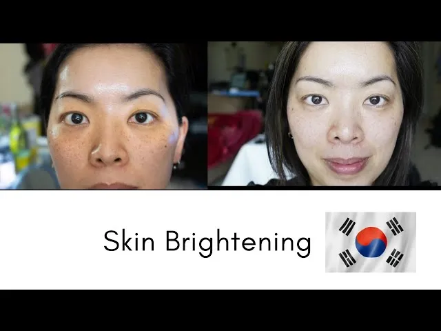 /img/29625-skin-whitening-surgery-cost.webp