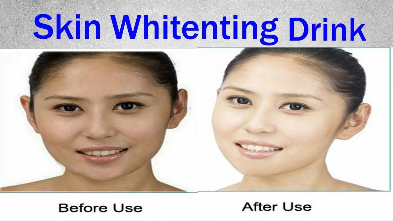 29627 sun exposure skin