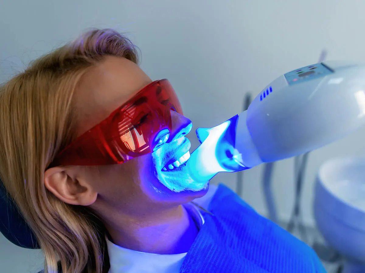 29629 teeth whitening colorado springs 3