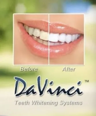 29629 teeth whitening colorado springs 6