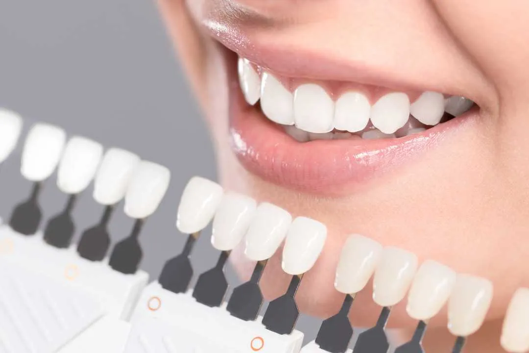 /img/29629-teeth-whitening-colorado-springs-7.webp