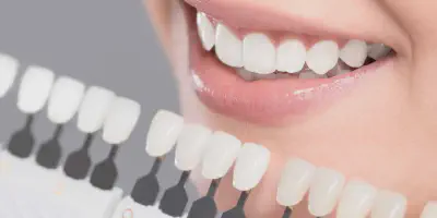 /img/29629-teeth-whitening-colorado-springs-7.webp