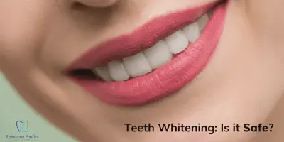/img/29635-laser-whitening-cost.webp