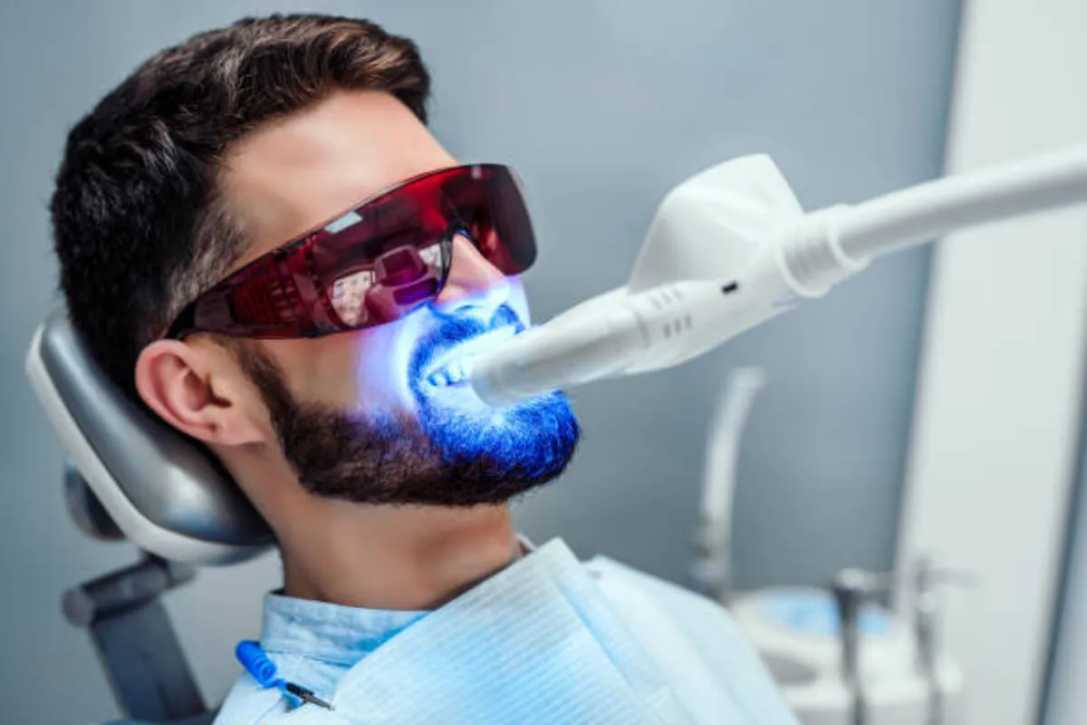 29635 laser whitening process