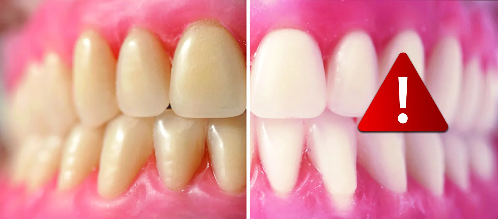 29640 tooth sensitivity
