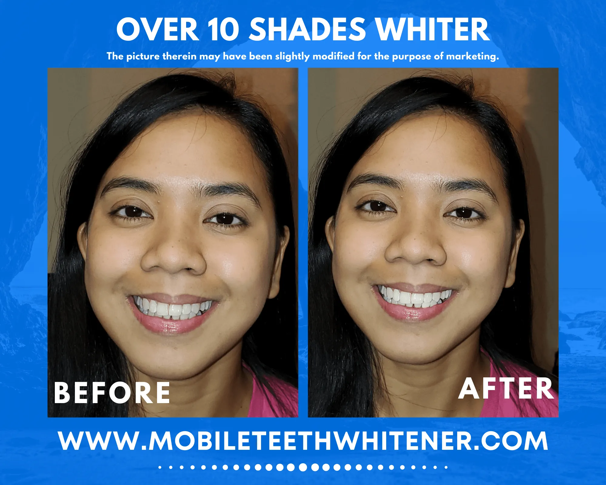 29642 mobile teeth whitening results