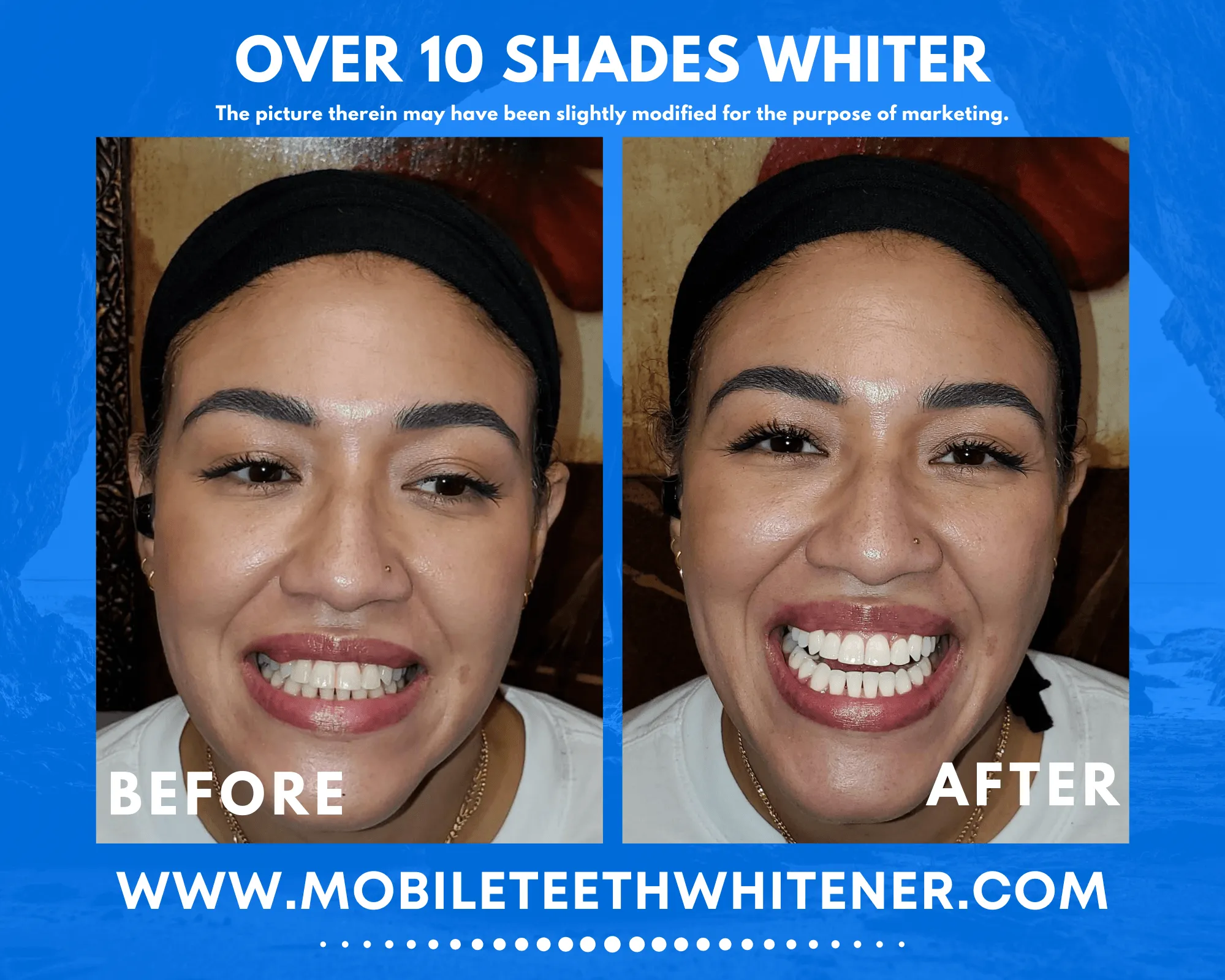 /img/29642-mobile-teeth-whitening-smile.webp